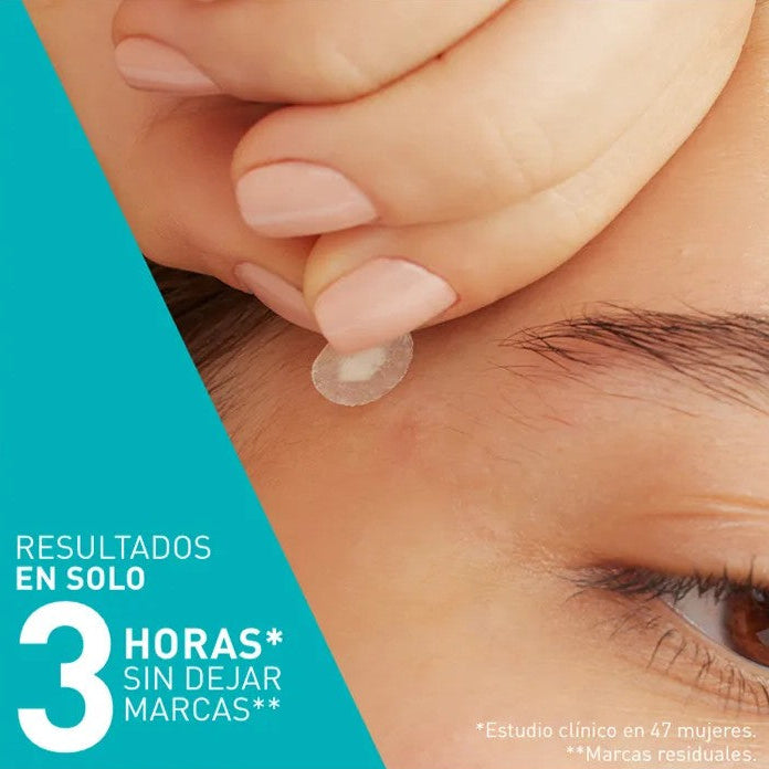 CeraVe Parches Anti-Granos 22 uds